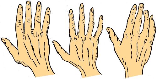 Hands - Palminstry