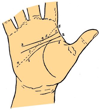 head line variations palmistry