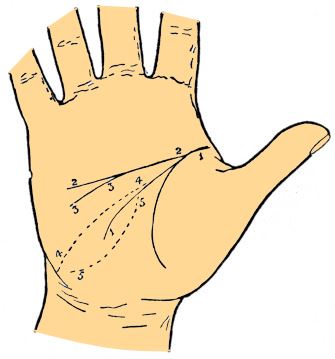 head line variations palmistry