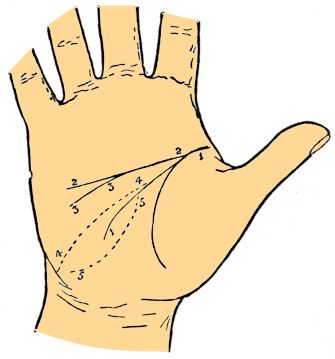 head line variations palmistry