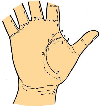 head line variations palmistry
